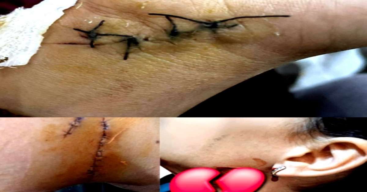 في مدرسة إعدادية بسكرة: تلميذة تطعن زميلتها بآلة حادة